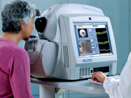 Tomographie de cohérence optique | OCT